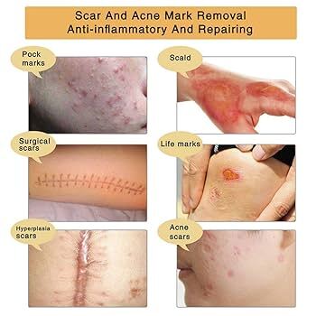 Japanese skin repair ointment with gentamicin sulfate