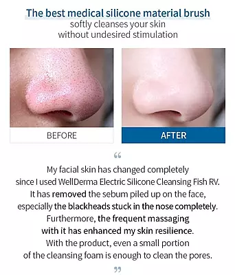 Close-up of silicone brush head – gentle cleansing for all skin types